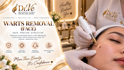 Warts Removal 